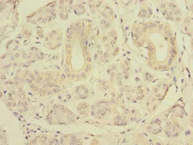 SLC4A8 Antibody