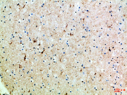 SLC6A1 Antibody