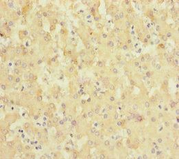SLC6A12 Antibody