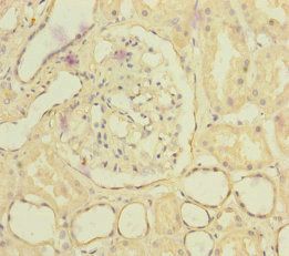 SLC6A12 Antibody
