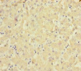 SLC6A12 Antibody