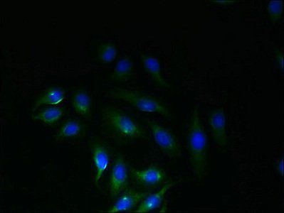 SLC6A16 Antibody