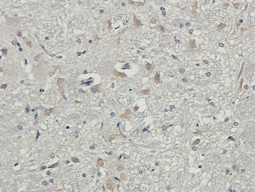 SLC6A5 antibody
