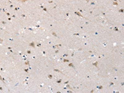 SLC6A7 Antibody