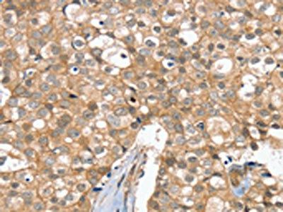 SLC6A7 Antibody