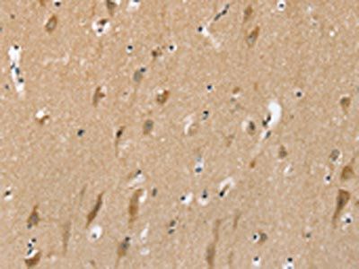 SLC6A7 Antibody