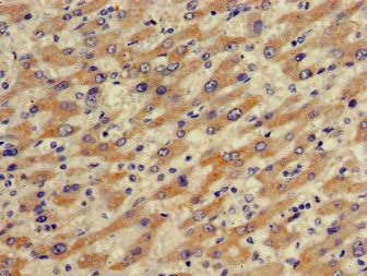 SLCO1B1 Antibody