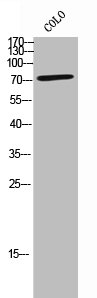 SLCO1B1 Antibody