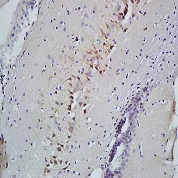 SLIT2 Rabbit Polyclonal Antibody