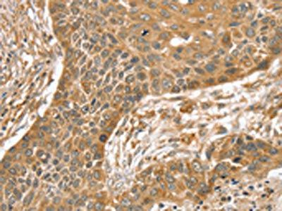 SLIT1 Antibody