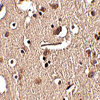 Slitrk2 Antibody