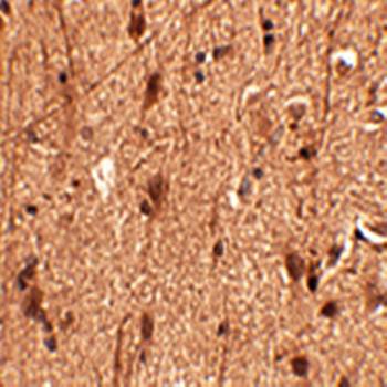 Slitrk3 Antibody