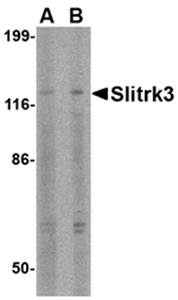Slitrk3 Antibody