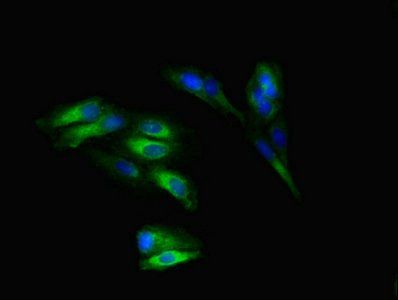 SLITRK5 Antibody