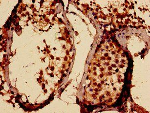SLITRK5 Antibody
