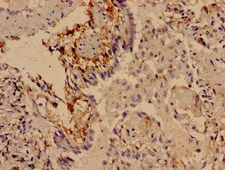 SLITRK5 Antibody