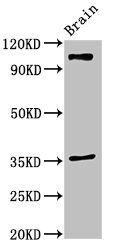 SLITRK5 Antibody