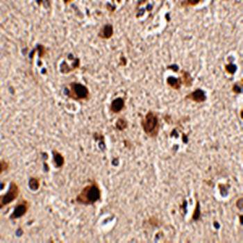 Slitrk5 Antibody