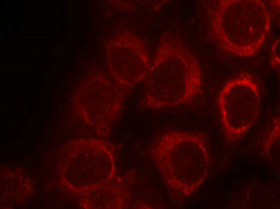 SMAD1 Antibody