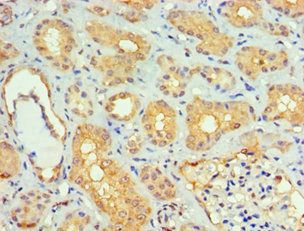 SMAD9 Antibody