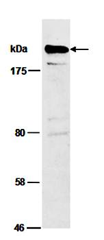 SMARCA2 (N) Antibody, Rabbit Polyclonal