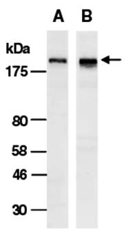 SMARCA2 (C) Antibody, Rabbit Polyclonal