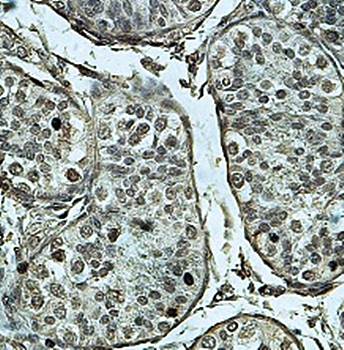 SMARCB1 Rabbit Polyclonal Antibody