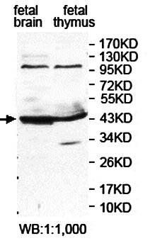 SMARCB1 Rabbit Polyclonal Antibody