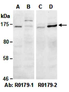 SMARCC1 (vPairTM) Antibodies