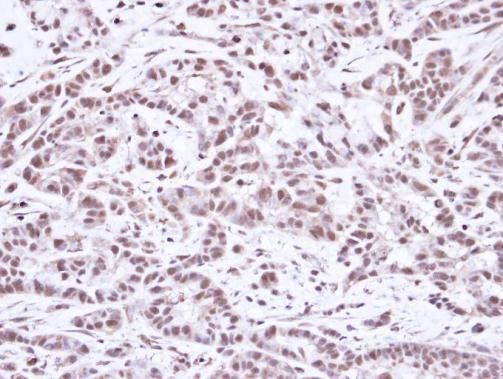 SMC1A Rabbit Polyclonal Antibody