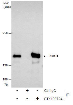 SMC1A Rabbit Polyclonal Antibody