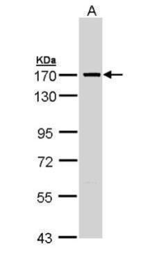 SMC1A Rabbit Polyclonal Antibody