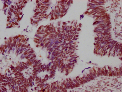 SMC1A Antibody