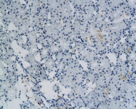 Heavy chain cardiac Myosin Rabbit Polyclonal Antibody