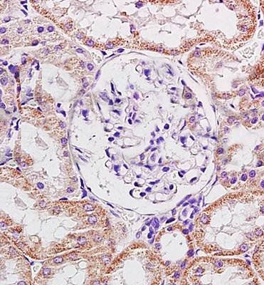 Heavy chain cardiac Myosin Rabbit Polyclonal Antibody