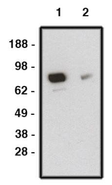Rabbit anti Human SMO (Smoothened Homolog) Antibody