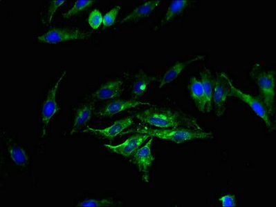 SGMS2 Antibody