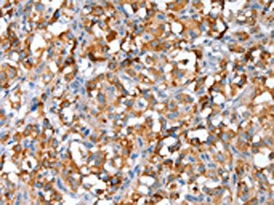 SNAI1 Antibody