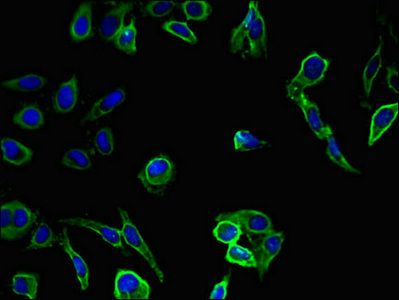 SNAI2 Antibody