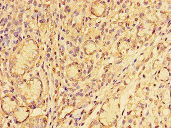 SNAI2 Antibody