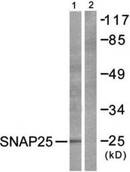 SNAP25 Antibody