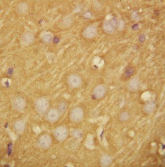 SNAP25 Rabbit Polyclonal Antibody