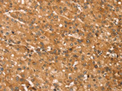 SNAP29 Antibody