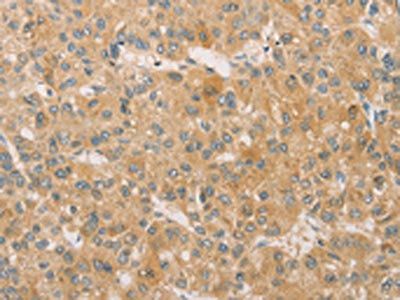 SNAP91 Antibody
