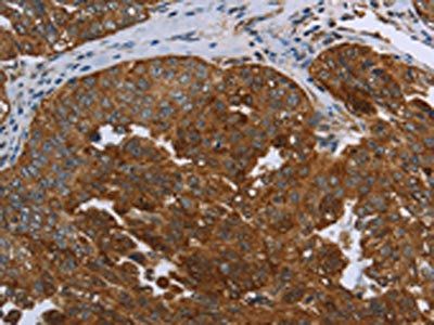 SNCG Antibody