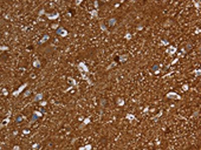 SNCG Antibody