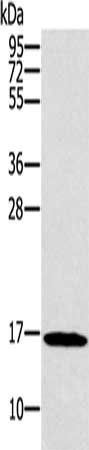 SNCG Antibody
