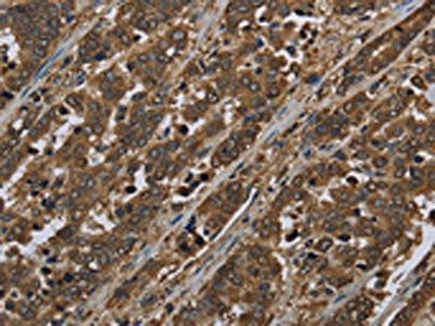 SNCG Antibody