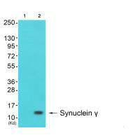 SNCG Antibody