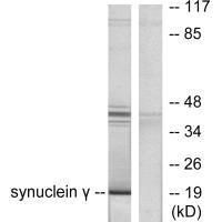 SNCG Antibody